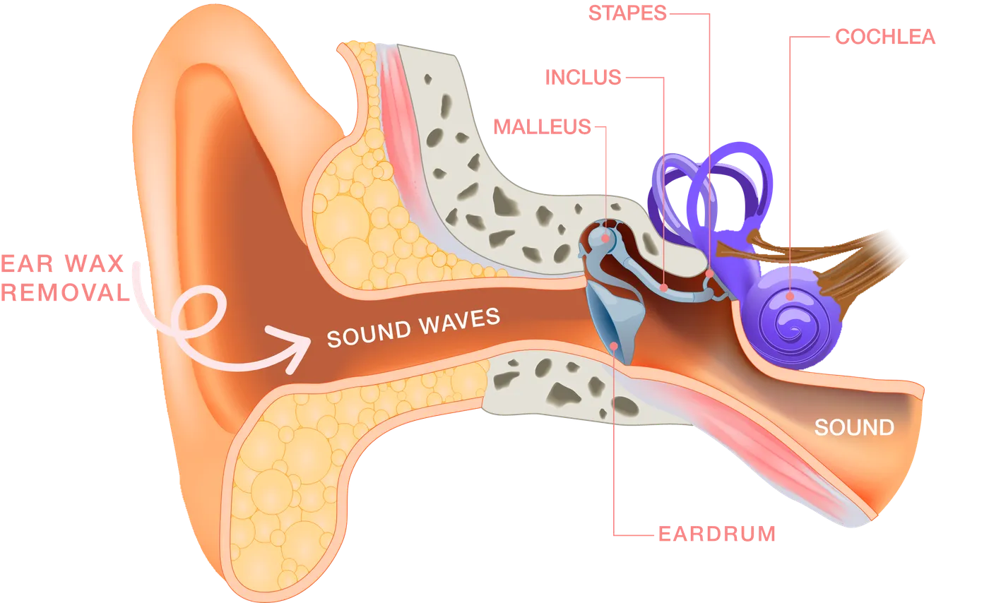 Schema ear wax removal